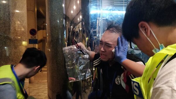 Hong Kong'da bıçaklı bir saldırgan, siyasetçi  Andrew Chiu Ka Yin'in kulağını ısırarak kopardı. - Sputnik Türkiye