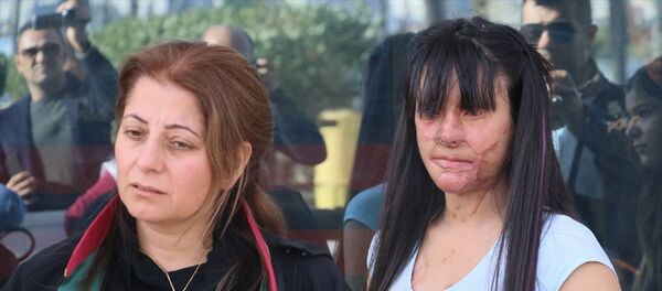 Hatay'ın İskenderun ilçesinde, 19 yaşındaki Berfin Özek'in(sağda) yüzüne asit dökerek sağ gözünü kaybetmesine ve yüzünün bir bölümünün yanmasına neden olduğu ileri sürülen sanığın, kasten öldürmeye teşebbüs suçundan müebbet hapis cezası istemiyle yargılandığı davanın duruşması görüldü. Özek ve avukatı Mehtap Sert(sodla) açıklamada bulundu. - Sputnik Türkiye