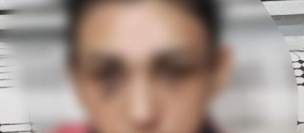 Eski eşinden şiddet gören kadın, sosyal medyadan yardım istedi: Can güvenliğimiz yok - Sputnik Türkiye