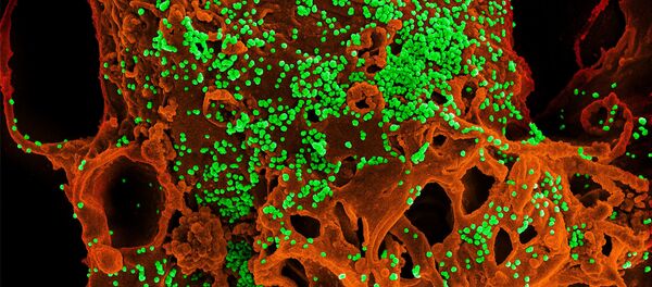 MERS Coronavirus Partikülleri - Sputnik Türkiye