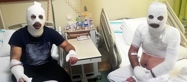 Kafetaryada tiner ile temizlik yaparken sigara yakan adam ve yardıma koşan arkadaşı alev aldı. İkilinin elleri ile yüzlerinde yanıklar oluştu - Sputnik Türkiye