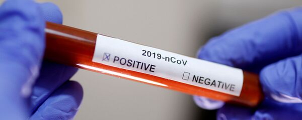 Koronavirüs pozitif yazılı test tübü  - Sputnik Türkiye