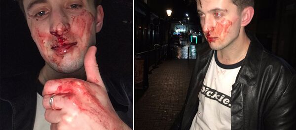 Bandicoot'un solisti ve gitaristi Rhys Underdown, Galli olduğu gerekçesiyle  İngiltere'yi terk et diye taciz edildi ve dövüldü. - Sputnik Türkiye