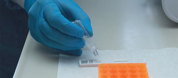 15 dakikada sonuç veren yeni tanı kiti - Sputnik Türkiye