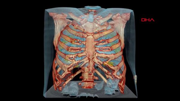 ABD’de bulunan George Washington Üniversitesi Hastanesi’ndeki doktorlar, koronavirüs (Covid-19) hastasının akciğerlerini 360 derece sanal gerçeklik teknolojisi kullanarak görüntüledi. - Sputnik Türkiye