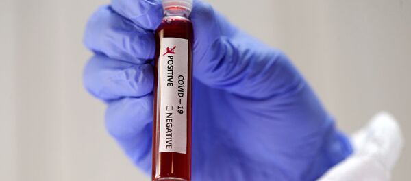 Koronavirüs testi - pozitif - Sputnik Türkiye