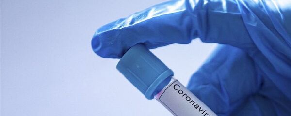 Koronavirüs, test Koronavirüs, test - Sputnik Türkiye