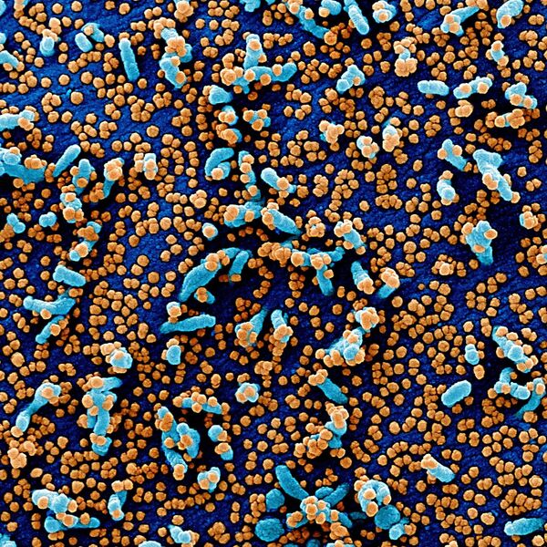 Koronavirüsün mikroskop görüntüleri - Sputnik Türkiye