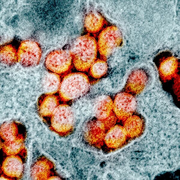Koronavirüsün mikroskop görüntüleri - Sputnik Türkiye
