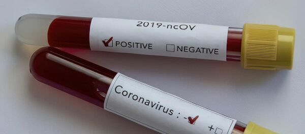 Koronavirüs pozitif - negatif - Sputnik Türkiye
