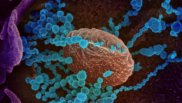 Yeni tip koronavirüsün (mavi noktalar) mikroskopik görüntüsü  - Sputnik Türkiye