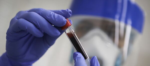 Koronavirus antikor testi Koronavirus antikor testi - Sputnik Türkiye