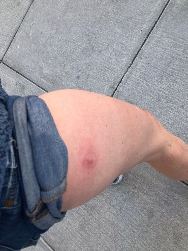 ABD'de polis Sputnik için çalışan gazeteciye plastik mermi sıktı - Sputnik Türkiye