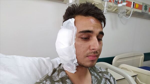 Karaman'da tartıştığı postacının kulağını ısırarak kopardığı iddiasıyla gözaltına alınan ve ev hapsi tedbiriyle serbest bırakılan şüpheli, karara yapılan itirazın ardından tutuklandı. - Sputnik Türkiye