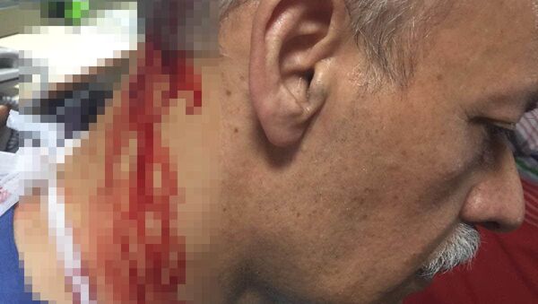 'Araba çarptı' diye ihbarda bulundu, hastanede doktora saldırdı - Sputnik Türkiye